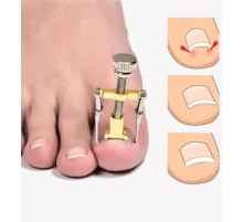 Batık Tırnak Düzeltme Aleti